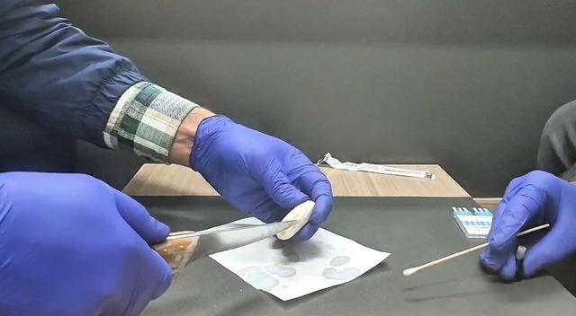 İranlı şüphelinin mide ve bağırsaklarında uyuşturucu bulundu